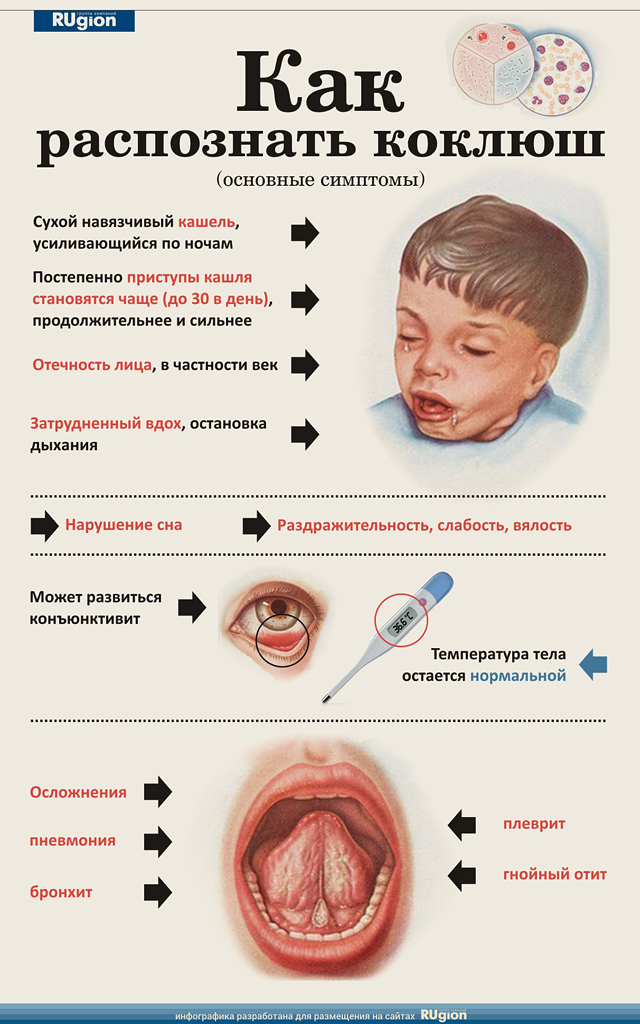 Коклюш у детей почему Коклюш у детей почему